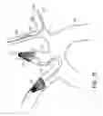 Fig. 16 - Vascular filters, deflectors, and methods