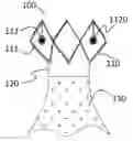 Fig. 01 - Prosthesis for preventing valve regurgitation
