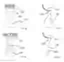 Fig. 08 - Prosthesis for preventing valve regurgitation