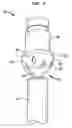 Fig. 06 - Alignment of an implantable medical device