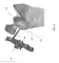 Fig. 06 - METHOD OF GLENOHUMERAL INSTABILITY REPAIR