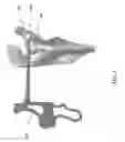 Fig. 07 - METHOD OF GLENOHUMERAL INSTABILITY REPAIR