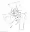 Fig. 01 - Customized patient-specific orthopaedic instruments for component placement in a total hip arthroplasty