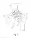 Fig. 02 - Customized patient-specific orthopaedic instruments for component placement in a total hip arthroplasty