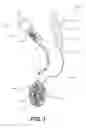 Fig. 02 - Minimally invasive biomaterial injection system