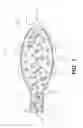 Fig. 04 - Minimally invasive biomaterial injection system
