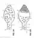 Fig. 07 - Minimally invasive biomaterial injection system