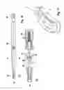 Fig. 05 - Intervertebral cage which is expandable in steps and implantation instrument therefor