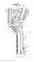 Fig. 03 - Surgical instrument for implant insertion