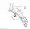 Fig. 08 - Surgical instrumentation assembly for positioning an ankle prosthesis