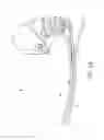 Fig. 05 - Prosthetic foot with enhanced stability and elastic energy return