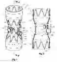 Fig. 02 - Fenestrated stent grafts