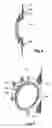 Fig. 05 - Fenestrated stent grafts