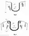Fig. 06 - Fenestrated stent grafts