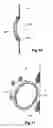 Fig. 07 - Fenestrated stent grafts