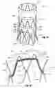 Fig. 09 - Fenestrated stent grafts