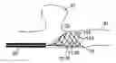 Fig. 01 - Medical device and system having such a device