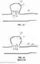 Fig. 02 - Medical device and system having such a device