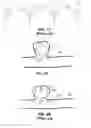 Fig. 03 - Medical device and system having such a device