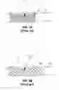 Fig. 06 - Medical device and system having such a device