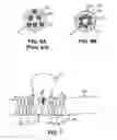 Fig. 07 - Medical device and system having such a device