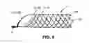Fig. 08 - Medical device and system having such a device
