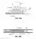 Fig. 13 - Medical device and system having such a device