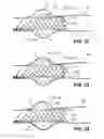 Fig. 17 - Medical device and system having such a device