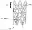Fig. 01 - BIOABSORBABLE STENT THAT MODULATES PLAQUE GEOMETRIC MORPHOLOGY AND CHEMICAL COMPOSITION