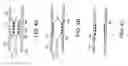 Fig. 05 - BIOABSORBABLE STENT THAT MODULATES PLAQUE GEOMETRIC MORPHOLOGY AND CHEMICAL COMPOSITION