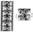 Fig. 11 - BIOABSORBABLE STENT THAT MODULATES PLAQUE GEOMETRIC MORPHOLOGY AND CHEMICAL COMPOSITION