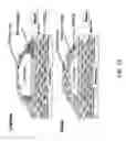 Fig. 24 - BIOABSORBABLE STENT THAT MODULATES PLAQUE GEOMETRIC MORPHOLOGY AND CHEMICAL COMPOSITION