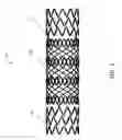 Fig. 02 - Transluminal angioplasty devices and methods of use