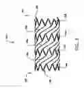 Fig. 04 - Transluminal angioplasty devices and methods of use