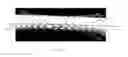 Fig. 12 - Transluminal angioplasty devices and methods of use