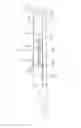 Fig. 04 - Extension assist device for an anatomic joint brace