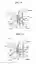 Fig. 06 - ORAL CAVITY INSERTION TOOL