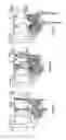 Fig. 09 - Eye drop warming apparatus