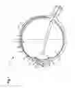 Fig. 02 - Apparatus and methods for ocular injection