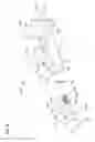 Fig. 25 - Apparatus and methods for ocular injection