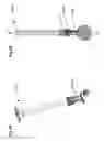 Fig. 52 - Apparatus and methods for ocular injection