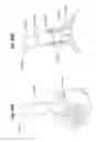 Fig. 89 - Apparatus and methods for ocular injection
