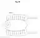 Fig. 93 - Apparatus and methods for ocular injection
