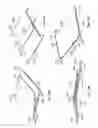 Fig. 22 - Controlled strain skin treatment devices and methods