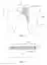 Fig. 34 - Dressing and Dressing Assembly for Preventing Pressure Ulcers
