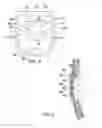 Fig. 04 - Toilet training assembly