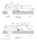 Fig. 12 - Surgical patient support system and method for lateral-to-prone support of a patient during spine surgery