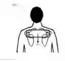 Fig. 05 - Inflatable medical apparatus
