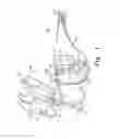 Fig. 02 - High frequency chest wall oscillation system
