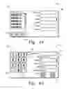 Fig. 33 - High frequency chest wall oscillation system